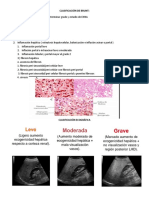 Clasificación de Brunt