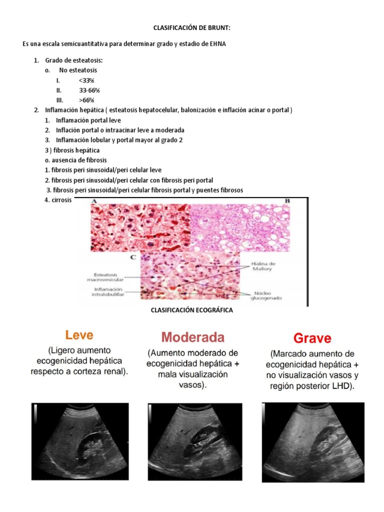 Clasificación de Brunt | PDF