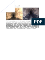 Videoinspeccion Inicial PDF