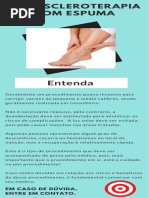 Pós escleroterapia com espuma - Dr. ALEXANDRE AMATO
