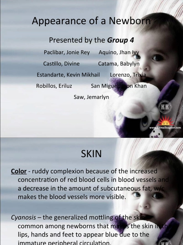 Appearance of A Newborn: Presented by The Group 4 | Download Free PDF ...
