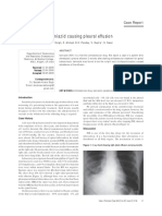 Isoniazid Causing Pleural Effusion: Case Report
