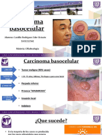 Ca Basocelular