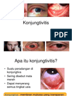 Konjungtivitis