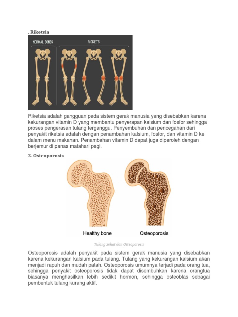 Penyakit Riketsia dan Penanganannya | PDF