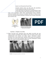 GAMBARAN KLINIS DAN HISTOPATOLOGI PULPITIS