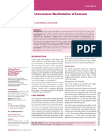 Cardiac Cirrhosis-An Uncommon Manifestation of Common Disease