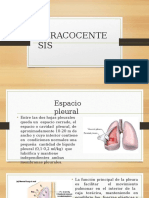 TORACOCENTESIS