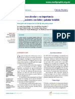 Injerto Óseo Alveolar y Su Importancia en Los Pacientes Con Labio y Paladar Hendido