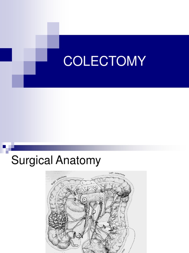 Colectomy Procedures and Techniques | PDF