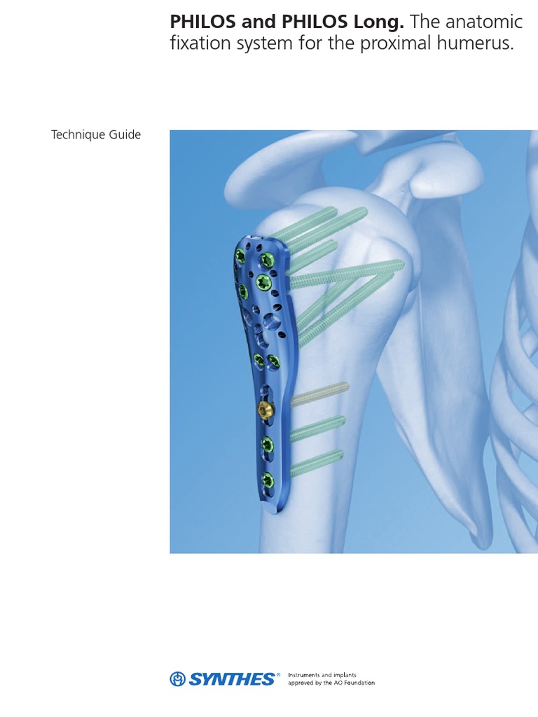 Fixation System For The Proximal Humerus Philos And Philos Long The Anatomic Screw Surgical Suture