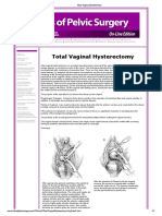 Total Vaginal Hysterectomy