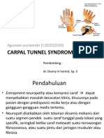 Carpal Tunnel Syndrome Print