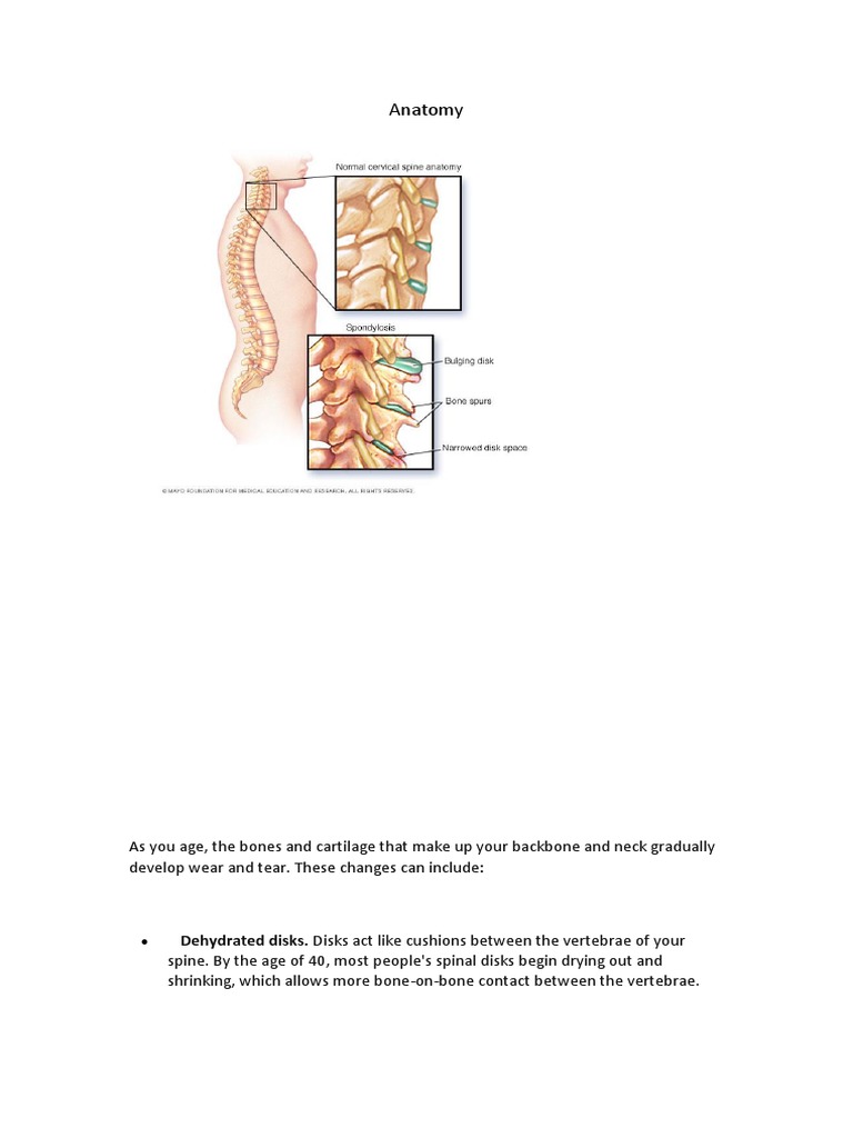 Anatomy Dehydrated Disks. Disks Act Like Cushions Between The Vertebrae of Your PDF