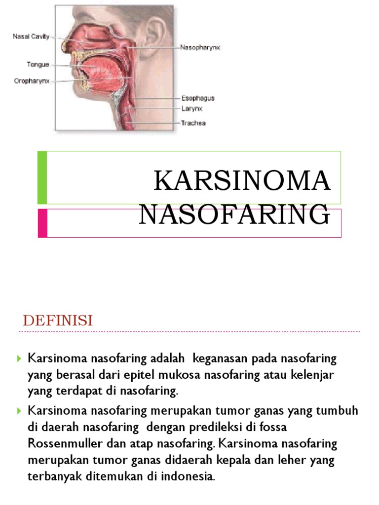 Karsinoma Nasofaring | PDF