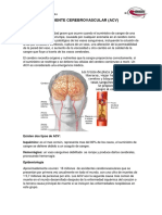 ACCIDENTE CEREBROVASCULAR.pdf