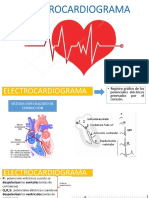 Electrocardiogram A