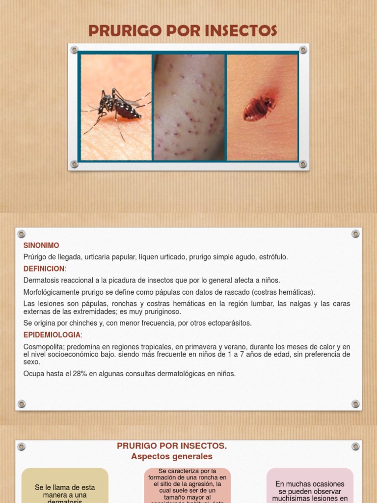 Prurigo por Insectos: Causas y Tratamiento | PDF | Sistema inmune ...