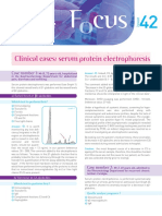 F Cus: Clinical Cases: Serum Protein Electrophoresis