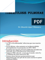 2.Tuberculosis Pulmonar.