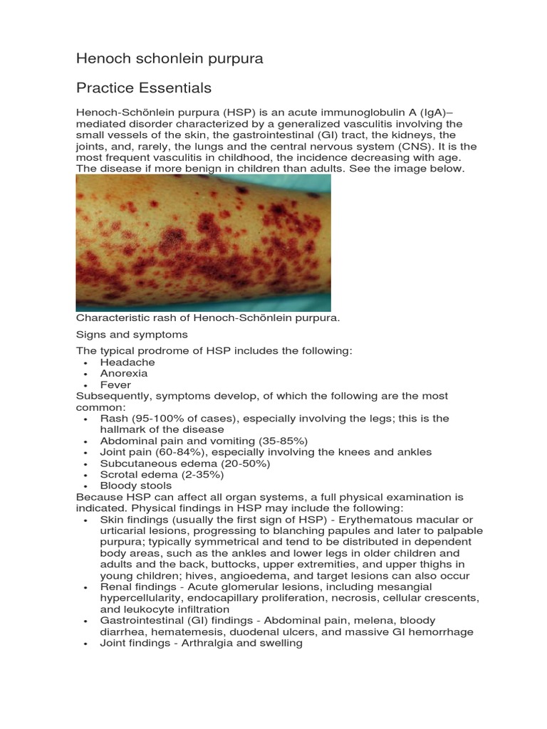 Pediatric Vasculitis Overview | PDF | Immunology | Health Sciences