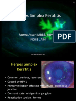 Herpes Simplex Keratitis