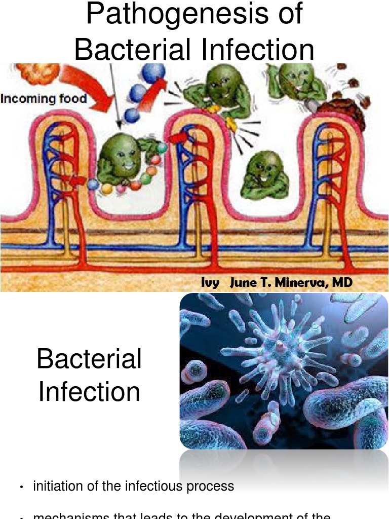 Ivy June T. Minerva, MD | PDF | Infection | Pathogen