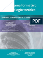 Introducción A La Radilogía Torácica PDF