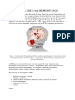 Intracerebral Hemorrhage Guide