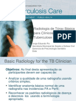 Radiologia de Tórax Básica na Tuberculose 2009