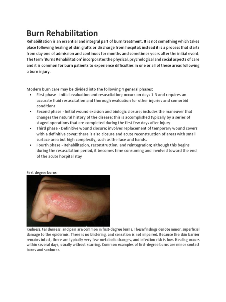 Burn Rehabilitation PDF Burn Skin