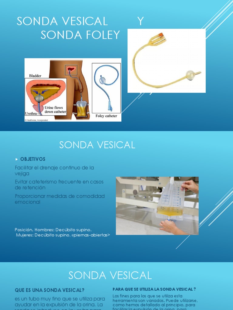 Sonda Vesical y Foley | PDF | Vejiga urinaria | Sistema urinario