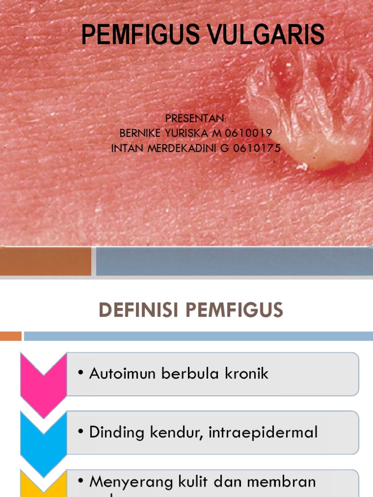 Presus Pemfigus Pdf