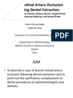 Branch Retinal Artery Occlusion Following Dental Extraction