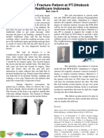 PTB AFO For Fracture Patient at PT - Ottobock Healthcare Indonesia