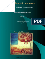 acousticneuroma.ppt