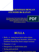 Bulla Terinfeksi Dengan Stenosis b6 Kanan