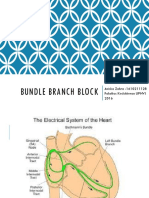 Bundle Branch Blocks