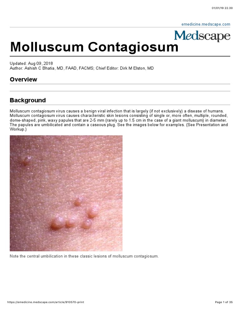 Condyloma acuminatum vs molluscum contagiosum, A betegség