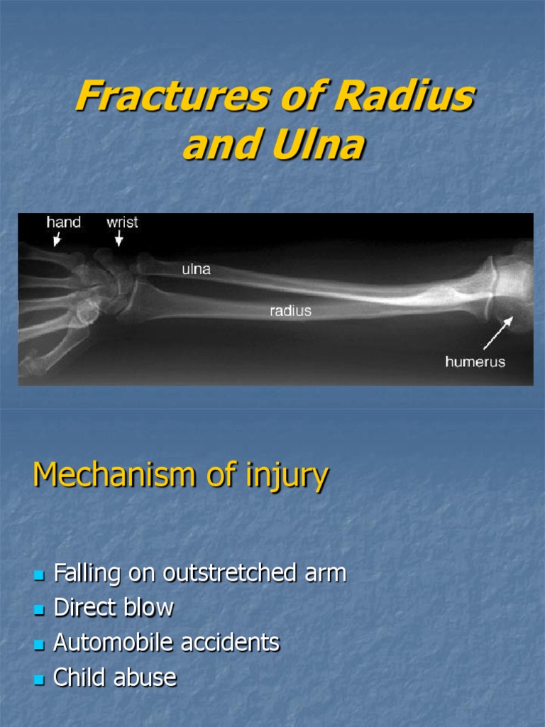 Fractures of Radius and Ulna | PDF | Self-Improvement | Science ...