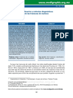 fx de radio distal.pdf