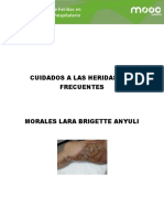 Cuidado de Heridas Mas Frecuentes