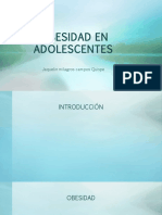 Obesidad en Adolescentes