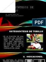 Osteosíntesis de Tobillo