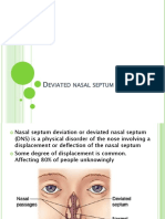 Deviated Nasal Septum