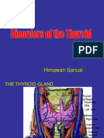Hipertiroid