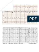 Latihan Ekg