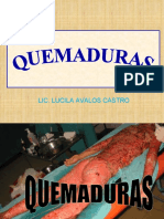 Quemaduras: causas, clasificación y tratamiento