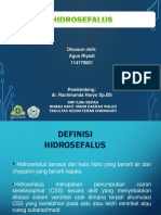 hidrosefalus Agus ppt.pptx