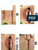 Posicion Tipo Labios